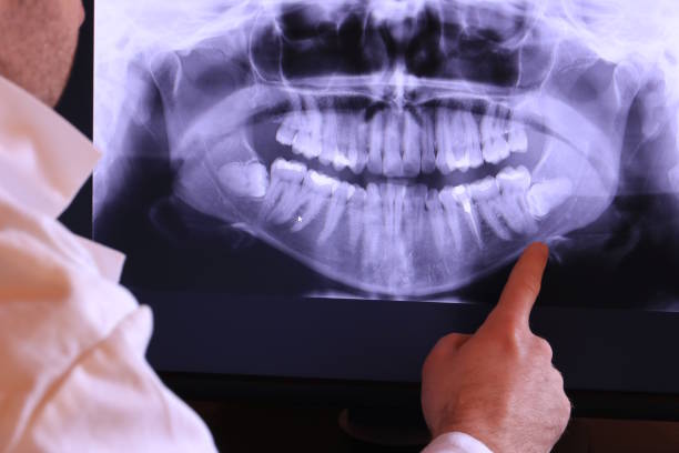 Best Emergency Gum Treatment in Wtell, LA